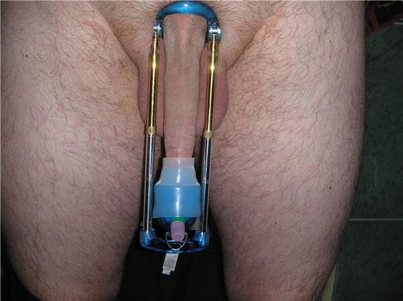Extender - penis enlargement device